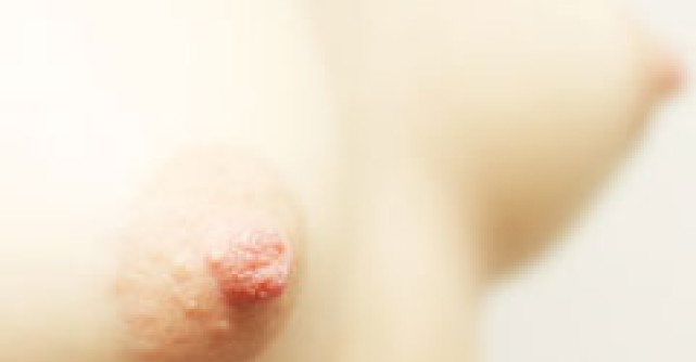 Mameloanele obraznice, la moda in randul femeilor