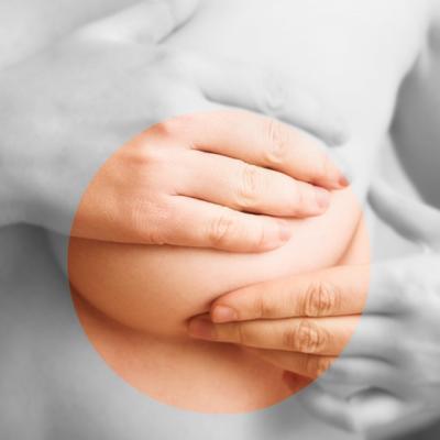 Ce sunt punctiile mamare si cum se realizeaza?