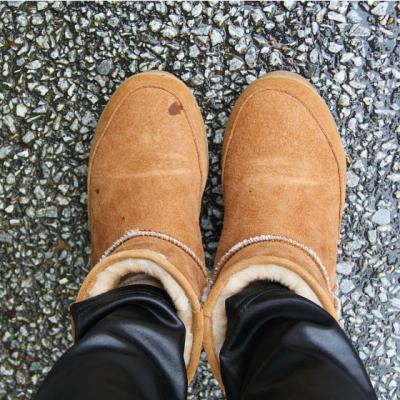 Protejeaza-ti picioarele pe timp de iarna!