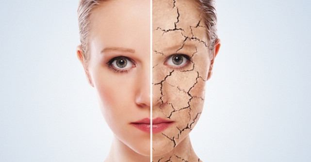 SOS salvati-mi pielea! Ce trebuie sa faci daca ai pielea foarte uscata