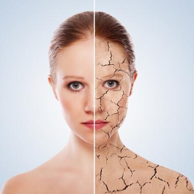 SOS salvati-mi pielea! Ce trebuie sa faci daca ai pielea foarte uscata