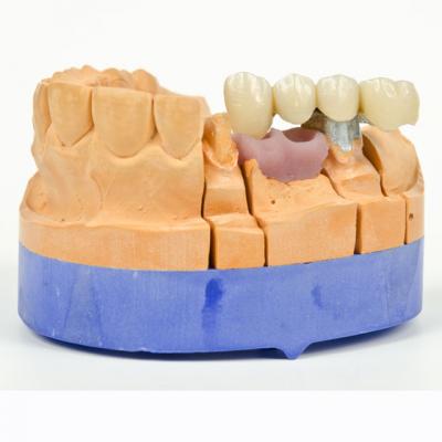 AJUTOR - 5 Cauze care pot duce la pierderea dintilor!