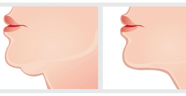 Acest exercitiu simplu te scapa de barbia dubla IMEDIAT