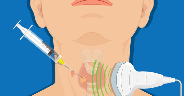 Tot ce trebuie să știi despre biopsii: beneficii, recomandări și tehnici de realizare