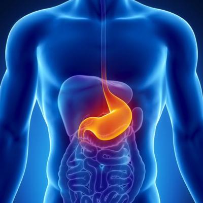 Top 4 factori de risc pentru aparitia cancerului gastric