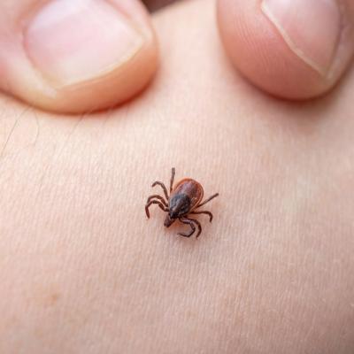 A început sezonul căpușelor! Cum ne protejăm de ele și ce trebuie făcut dacă le descoperim pe piele?