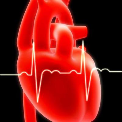 Infarctul miocardic. Tot ce trebuie sa cunosti despre