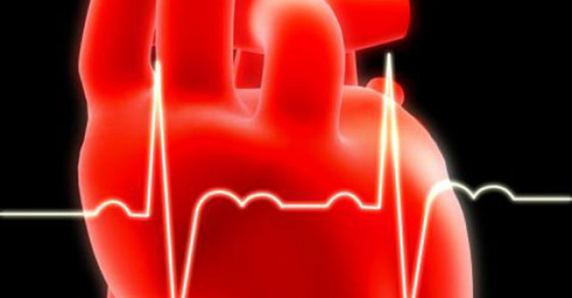 Infarctul miocardic. Tot ce trebuie sa cunosti despre