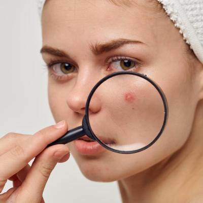 Ghid de supraviețuire pentru ten: cum îți pregătești rutina de îngrijire pentru sezonul rece