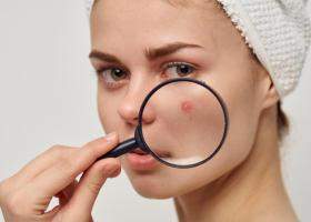 Ghid de supraviețuire pentru ten: cum îți pregătești rutina de îngrijire pentru sezonul rece