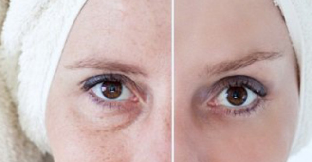 5 motive pentru care pielea pare imbatranita +5 solutii naturale