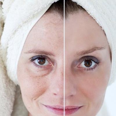 5 motive pentru care pielea pare imbatranita +5 solutii naturale