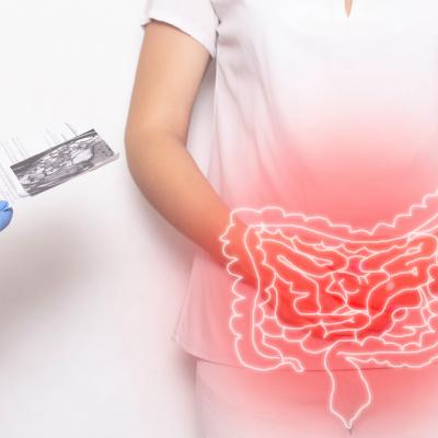 COLONOSCOPIA: metodă de diagnostic și tratament, dar și de prevenție și screening în cancerul colorectal