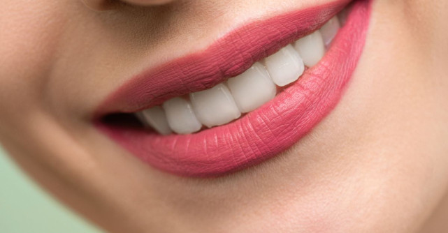 Cum ai grijă de coroane, fațete și punți dentare ca să reziste în timp?