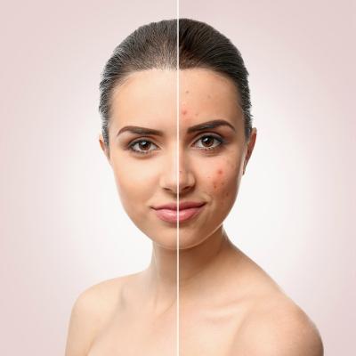 3 proceduri dermatocosmetice recomandate in aceasta toamna pentru o piele radianta