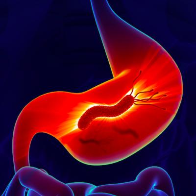 Arsuri la stomac, balonare, greață? Ai putea avea, fără să știi, infecție cu Helicobacter pylori