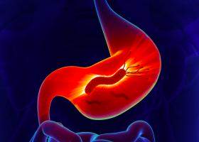Helicobacter pylory: ce este, cauze, simptome, diagnostic, tratament de baza si tratamente naturiste + complicatii