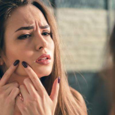 Ten acneic: cauze și soluții simple și ușor de pus în aplicare