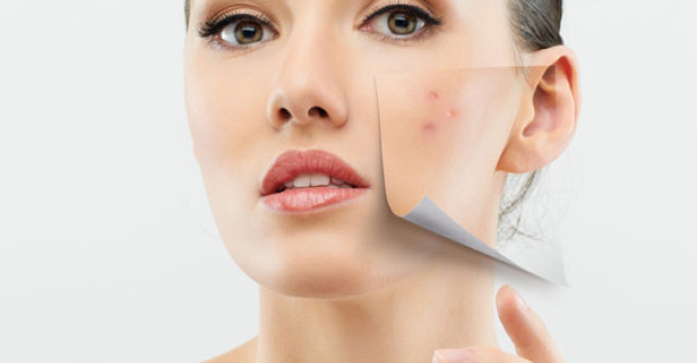 8 Produse BIO pentru ACNEE