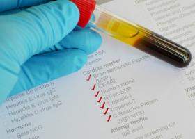 Proteina C reactiva: ce este si ce se intampla atunci cand valorile sale cresc