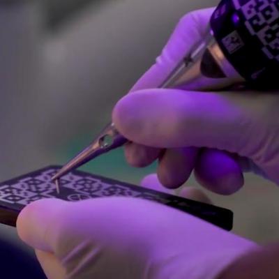 Implanturi dentare fără tăietură și fără durere,  cu revoluționarul sistem X-Guide de la Nobel Biocare