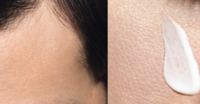 KERIUM DS - o noua solutie pentru tratarea dermatitei seboreice