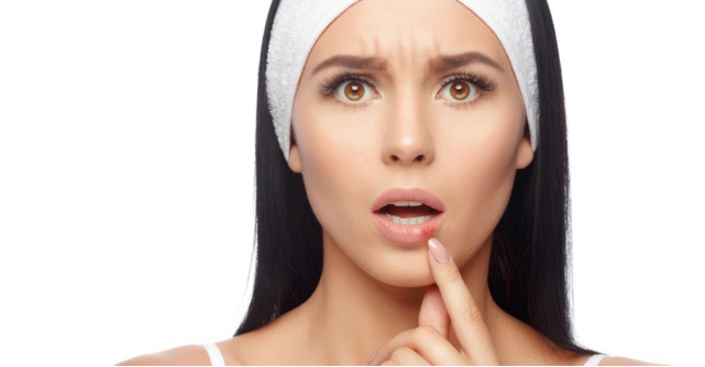 Herpes: simptome, cauze si care sunt posibilele complicatii mai grave