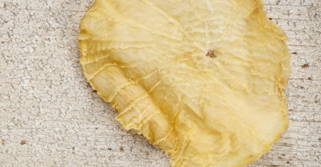 Probioticele: Sistemul digestiv iti spune 'Multumesc'