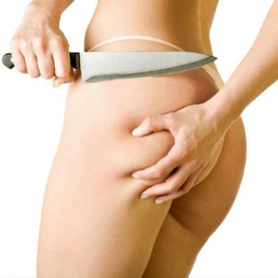 Tratamente pentru combaterea celulitei si reducerea kilogramelor in plus