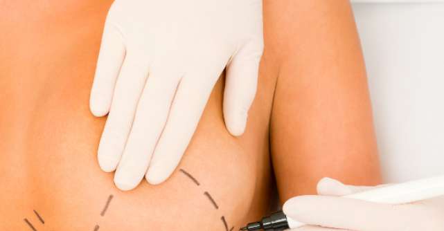 Mitul implanturilor mamare: rotunde sau anatomice, afla care ti se potrivesc!