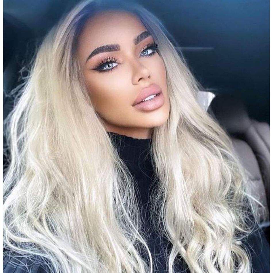 Bianca Drăgușanu, apel disperat pe Instagram! Vedeta le-a cerut ajutorul internauților în legătură cu o problemă de sănătate