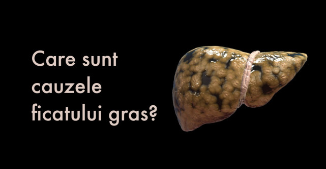 3 Remedii naturale pentru FICAT GRAS