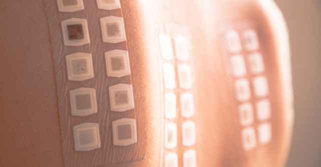 Dermatita de contact și Testarea patch