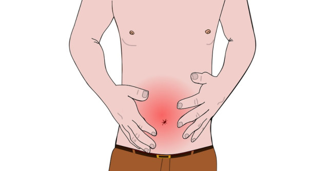 Tratamente naturiste pentru arsurile la stomac