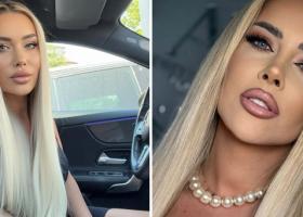 Oana Monea, ispita de la Insula Iubirii, diagnosticată cu semipareză: Am fost singură, am făcut un șoc...