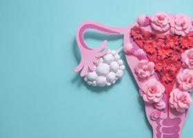 Totul despre ovarele polichistice