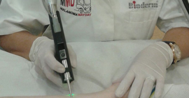 Cinci mituri despre vasele sparte: Cum scapi de inestetica problema de pe picioare