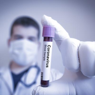 Trei lucruri pe care trebuie să le știi despre Coronavirus