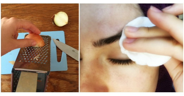 Foloseste suc de ceapa pentru sprancene. Trebuie sa incercati si voi asta