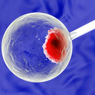 Medicina regenerativa: ce poti face cu celulele stem