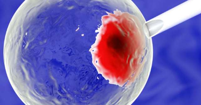 Medicina regenerativa: ce poti face cu celulele stem