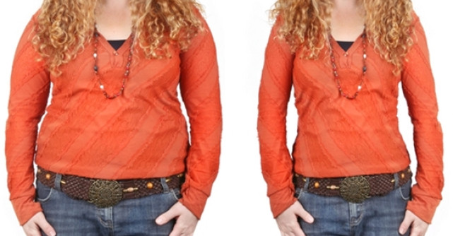 TRANSFORMARE SPECTACULOASA cu ajutorul operatiilor estetice