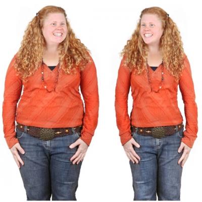 TRANSFORMARE SPECTACULOASA cu ajutorul operatiilor estetice