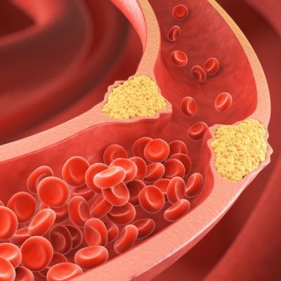 Fructul care poate reduce colesterolul: cum acționează și cum îl poți include zilnic în alimentație