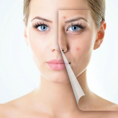 3 proceduri dermatocosmetice recomandate in aceasta toamna pentru o piele radianta