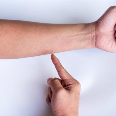 Vasculita, boala autoimuna care afecteaza vasele de sange. Simptome, cauze si tratament