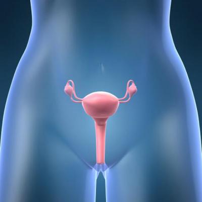 Sindromul ovarelor polichistice si cum poate afecta viata unei femei