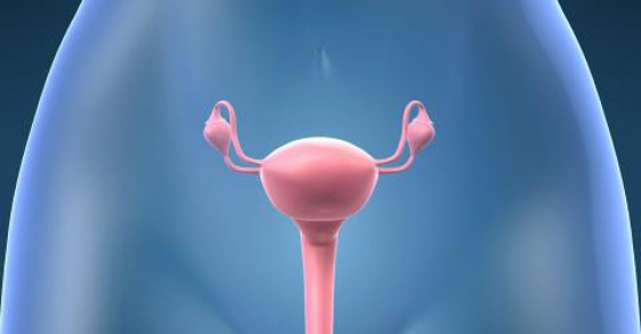 Sindromul ovarelor polichistice si cum poate afecta viata unei femei