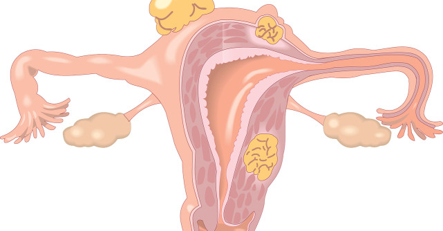 Fitoestrogenii, hormoni de la natura