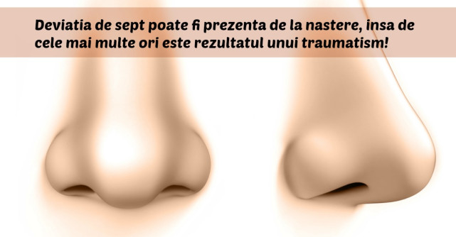 Deviatia de sept: o afectiune ce nu trebuie ignorata